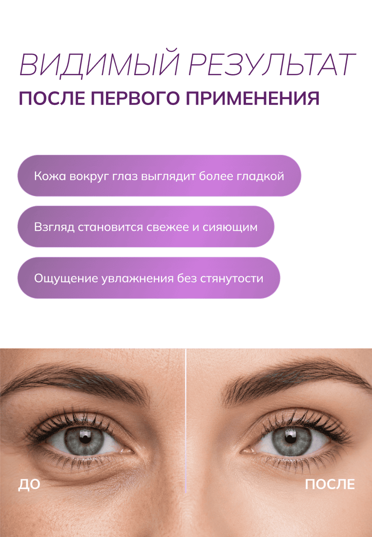 Von-U Антивозрастной крем для век Age Reverse Eye Cream 25ml